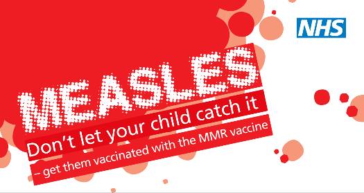 Measles NHS Don't let your child get caught